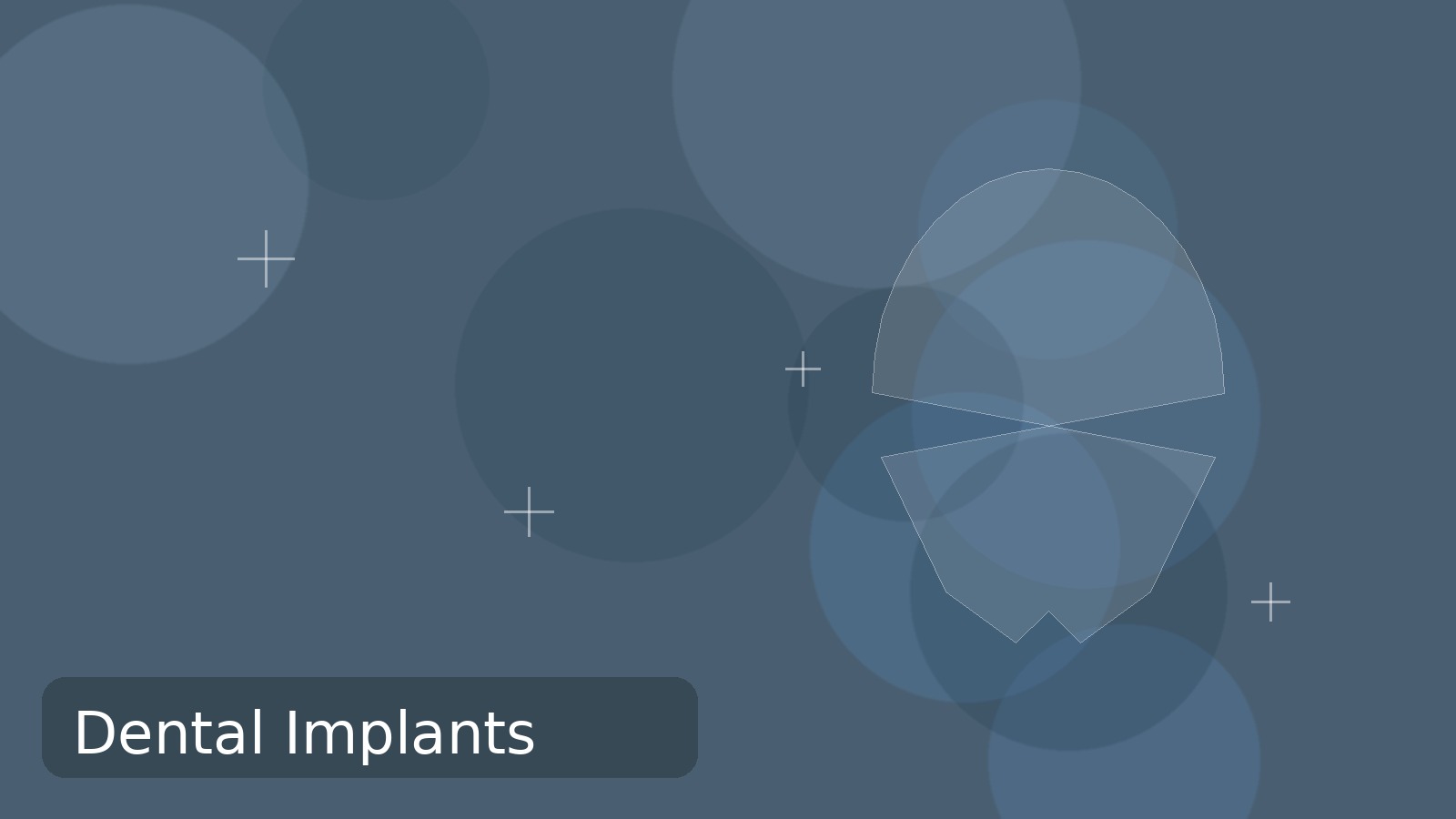 Dental implant restoration for missing teeth